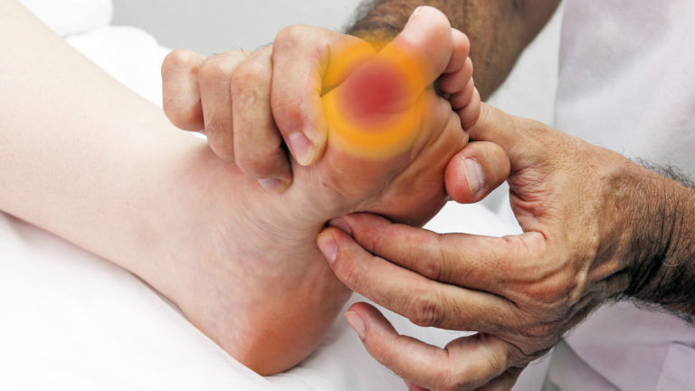 Elithera Aktuell: Gicht: Wie Physiotherapie Schmerzen lindern und Bewegungseinschränkungen verbessern kann