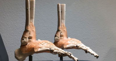 Richtiges Schuhwerk und Einlagen